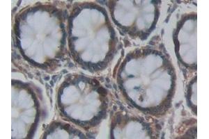 Immunohistochemistry (IHC) image for anti-Hemochromatosis Type 2 (Juvenile) (HFE2) (AA 41-386) antibody (ABIN7441934)