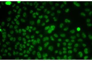 Immunofluorescence analysis of HeLa cells using CSNK2A2 Polyclonal Antibody (CSNK2A2 Antikörper)