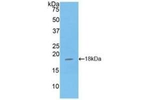 Detection of Recombinant GPX4, Mouse using Polyclonal Antibody to Glutathione Peroxidase 4 (GPX4)