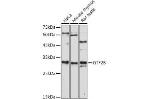 Western blot analysis of extracts of various cell lines, using GTF2B antibody (ABIN7267370) at 1:1000 dilution.