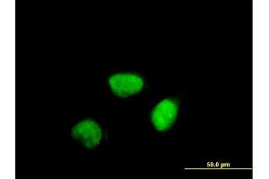 Immunofluorescence of purified MaxPab antibody to CCNA2 on HeLa cell. (Cyclin A Antikörper  (AA 1-432))