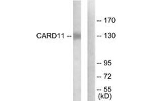Western blot analysis of extracts from COLO205 cells, using CARD11 Antibody.