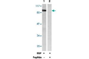 Western blot analysis of extracts from HeLa cells, treated with EGF (200 ng/mL, 30 mins), using CALD1 polyclonal antibody . (Caldesmon Antikörper)