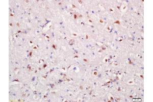 Immunohistochemistry (Paraffin-embedded Sections) (IHC (p)) image for anti-Harakiri, BCL2 Interacting Protein (Contains Only BH3 Domain) (HRK) (AA 1-50) antibody (ABIN2559409)