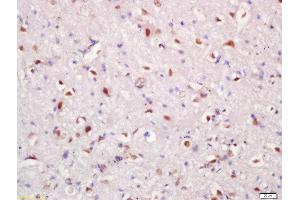 Formalin-fixed and paraffin embedded rat brain tissue labeled with Rabbit Anti-Hrk Polyclonal Antibody, Unconjugated (ABIN2559409) at 1:200 followed by conjugation to the secondary antibody and DAB staining (HRK Antikörper  (AA 1-50))
