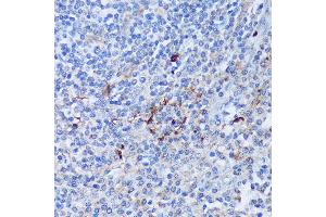 Immunohistochemistry of paraffin-embedded Human tonsil using P antibody (ABIN7269207) at dilution of 1:100 (40x lens).