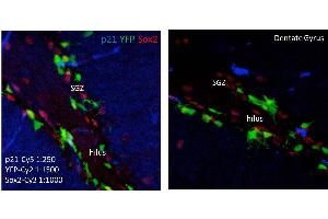 Immunohistochemistry of Mouse anti-p21 antibody. (p21 Antikörper)