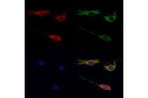ABIN6259651 and ABIN6268999 staining HepG2 by IF/ICC.