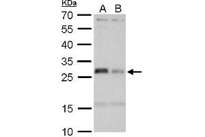 WB Image HLA-DMA antibody detects HLA-DMA protein by Western blot analysis. (HLA-DMA Antikörper)