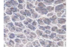 Immunohistochemistry (IHC) image for anti-DnaJ (Hsp40) Homolog, Subfamily C, Member 2 (DNAJC2) (AA 368-621) antibody (ABIN7444604)