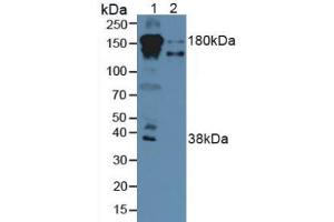 Western blot analysis of (1) Human Serum and (2) Human Liver Tissue. (Complement Factor H Antikörper  (AA 860-1231))