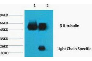 Immunoprecipitation (IP) analysis: 1) Input: Mouse Brain Tissue Lysate. (TUBB2A Antikörper)