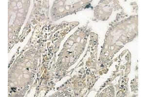 ABIN6257502 and ABIN6274398 at 1/100 staining human normal colon tissue by IHC-P.