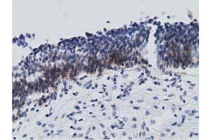 Immunohistochemical staining of paraffin-embedded Human bladder tissue using anti-RBBP9 mouse monoclonal antibody.