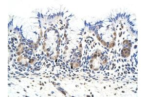 PRKRA antibody was used for immunohistochemistry at a concentration of 4-8 ug/ml to stain Epithelial cells of fundic gland (arrows) in Human Stomach.