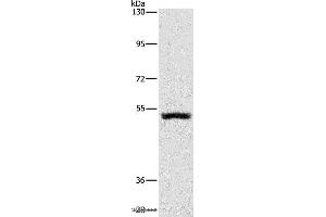 Western blot analysis of Mouse kidney tissue, using SYT17 Polyclonal Antibody at dilution of 1:650 (SYT17 Antikörper)