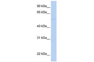 Perforin 1 antibody used at 1 ug/ml to detect target protein.