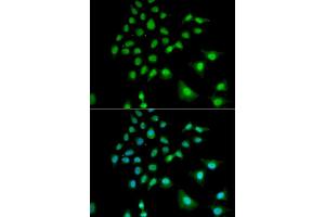 Immunofluorescence analysis of U2OS cells using UBE3C antibody (ABIN5973842). (UBE3C Antikörper)