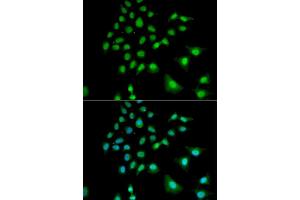Immunofluorescence analysis of U2OS cells using UBE3C antibody (ABIN5973842). (UBE3C Antikörper)