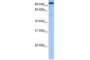 WB Suggested Anti-CPSF2 Antibody Titration:  0. (CPSF2 Antikörper  (N-Term))