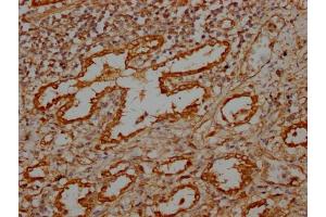 IHC image of ABIN7159372 diluted at 1:100 and staining in paraffin-embedded human lung tissue performed on a Leica BondTM system. (MBTPS1 Antikörper  (AA 187-400))
