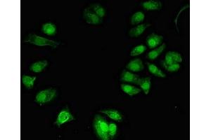 Immunofluorescent analysis of MCF-7 cells using ABIN7172301 at dilution of 1:100 and Alexa Fluor 488-congugated AffiniPure Goat Anti-Rabbit IgG(H+L) (NFKBIL2 Antikörper  (AA 668-955))
