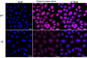 Immunocytochemical staining of HeLa cells using Galactosidase alpha antibody (ABIN7798683), 1:1,000), Top panel: wild-type (WT), Bottom panal: Adiponectin receptor 1 shRNA knockdown (KD).