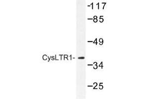 Image no. 1 for anti-Cysteinyl Leukotriene Receptor 1 (CYSLTR1) antibody (ABIN317631) (CysLTR1 Antikörper)