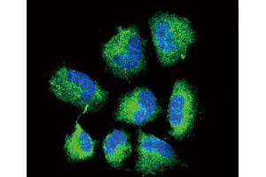 Confocal immunofluorescent analysis of CHAT Antibody (N-term) (ABIN653544 and ABIN2842929) with NCI- cell followed by Alexa Fluor? (Choline Acetyltransferase Antikörper  (N-Term))