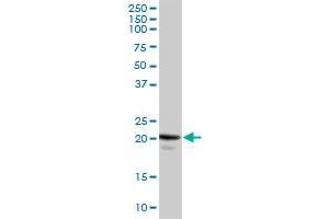 CAV1 MaxPab rabbit polyclonal antibody. (Caveolin-1 Antikörper  (AA 1-178))