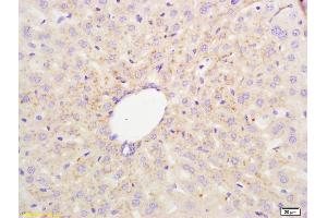 Immunohistochemistry (IHC) image for anti-ATP-Binding Cassette, Sub-Family G (WHITE), Member 8 (ABCG8) (AA 566-673) antibody (ABIN1387509)