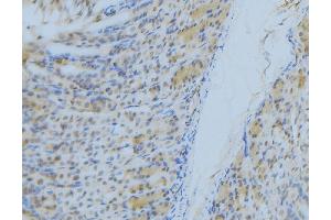 ABIN6277300 at 1/100 staining Human gastric tissue by IHC-P. (NDUFS1 Antikörper  (N-Term))