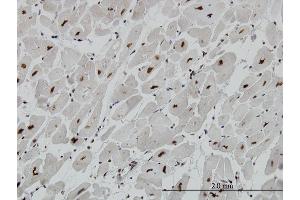 Immunoperoxidase of monoclonal antibody to MECP2 on formalin-fixed paraffin-embedded human heart. (MECP2 Antikörper  (AA 81-170))