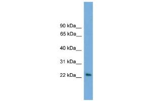 WB Suggested Anti-RAB15 Antibody Titration: 0. (RAB15 Antikörper  (Middle Region))