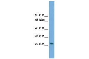 WB Suggested Anti-RAB15 Antibody Titration: 0. (RAB15 Antikörper  (Middle Region))