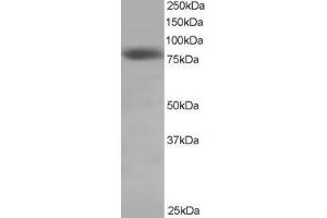 Western Blotting (WB) image for anti-NDC80 Kinetochore Complex Component Homolog (NDC80) (C-Term) antibody (ABIN2465807) (NDC80 Antikörper  (C-Term))