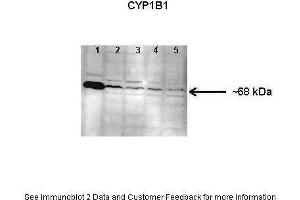 Lanes:  Lane 1: Human lung microsome lysate Lane 2-5: 150 ug mouse lung microsome lysate Primary Antibody Dilution:  1: 1000 Secondary Antibody:  Anti-rabbit HRP Secondary Antibody Dilution:  1: 10000 Gene Name:  CYP1B1 Submitted by:  Jing Peng, Fox Chase Cancer Center (CYP1B1 Antikörper  (Middle Region))