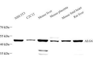 Western blot analysis of ALG6 (ABIN7073127) at dilution of 1: 1000 (ALG6 Antikörper)