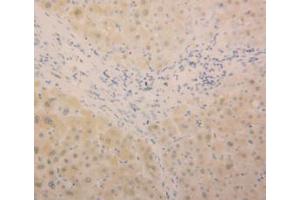 IHC-P analysis of Human Liver Tissue, with DAB staining. (ALT Antikörper  (AA 367-480))