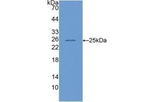 Western blot analysis of recombinant Mouse COMP. (COMP Antikörper  (AA 554-753))