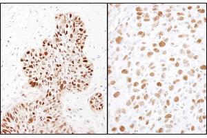 Immunohistochemistry (IHC) image for anti-Minichromosome Maintenance Complex Component 2 (MCM2) (pSer41) antibody (ABIN7449367)
