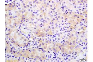 Immunohistochemistry (IHC) image for anti-ATPase, Ca++ Transporting, Plasma Membrane 2 (ATP2B2) (AA 361-460) antibody (ABIN1385852)