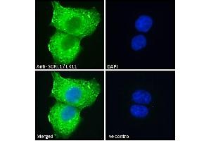 ABIN184579 Immunofluorescence analysis of paraformaldehyde fixed A431 cells, permeabilized with 0. (SORL1 Antikörper  (C-Term))