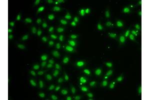 Immunofluorescence analysis of MCF-7 cells using DUSP22 antibody (ABIN4903528). (DUSP22 Antikörper)
