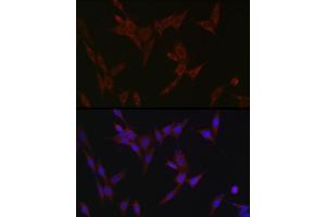 Immunofluorescence (IF) image for anti-Solute Carrier Family 39 (Zinc Transporter), Member 14 (SLC39A14) (AA 240-340) antibody (ABIN6147993)