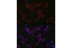 Immunofluorescence analysis of NIH/3T3 cells using ZIP14 Rabbit pAb (ABIN6133191, ABIN6147993, ABIN6147994 and ABIN6214658) at dilution of 1:100 (40x lens). (SLC39A14 Antikörper  (AA 240-340))