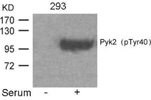 Western blot analysis of extracts from 293 cells untreated or treated with Serum using Pyk2(Phospho-Tyr402) Antibody.