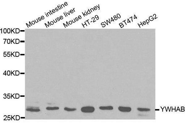 YWHAB Antikörper  (AA 1-246)