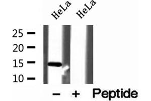 Western blot analysis of extracts of HeLa cells, using UQCRB antibody. (UQCRB Antikörper  (N-Term))