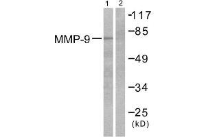 Western blot analysis of extracts from HepG2 cells, using MMP9 antibody (ABIN5976466). (MMP 9 Antikörper  (C-Term))